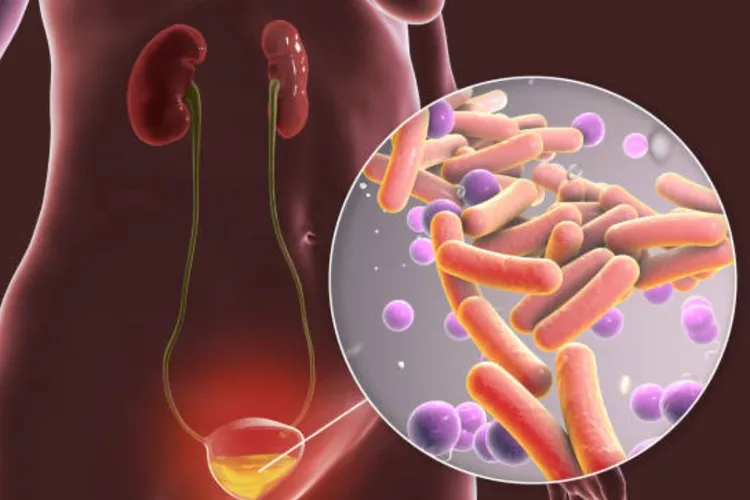Infeksi Saluran Kemih