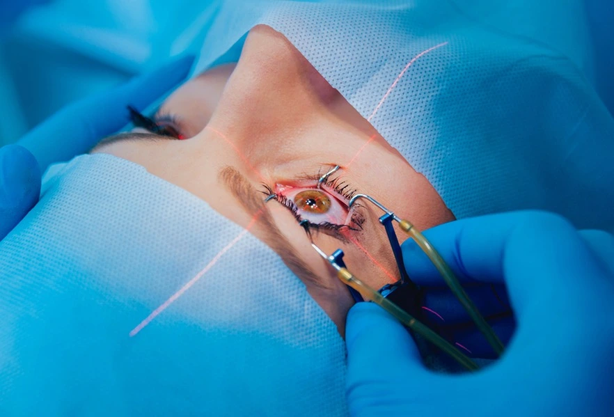 Lasik Mata