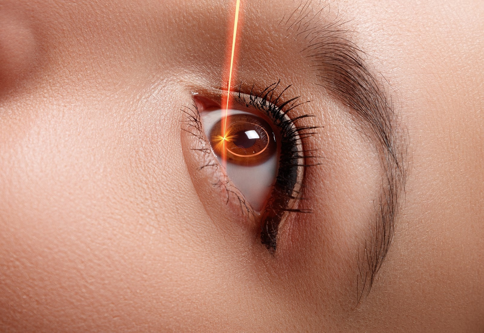 Mengenal Lasik Mata dan Cara Kerjanya